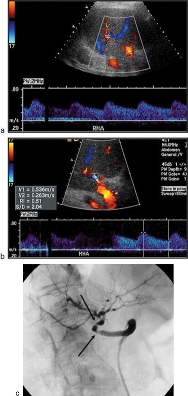 Fig. 11