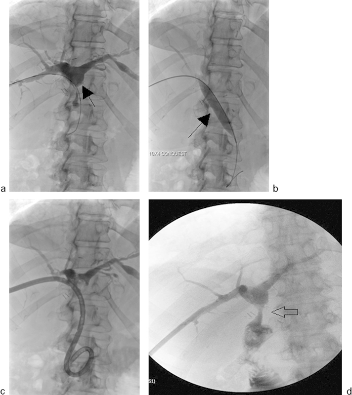 Fig. 15