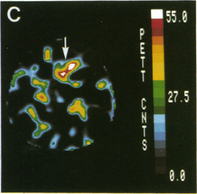 graphic file with name pnas01026-0276-d.jpg