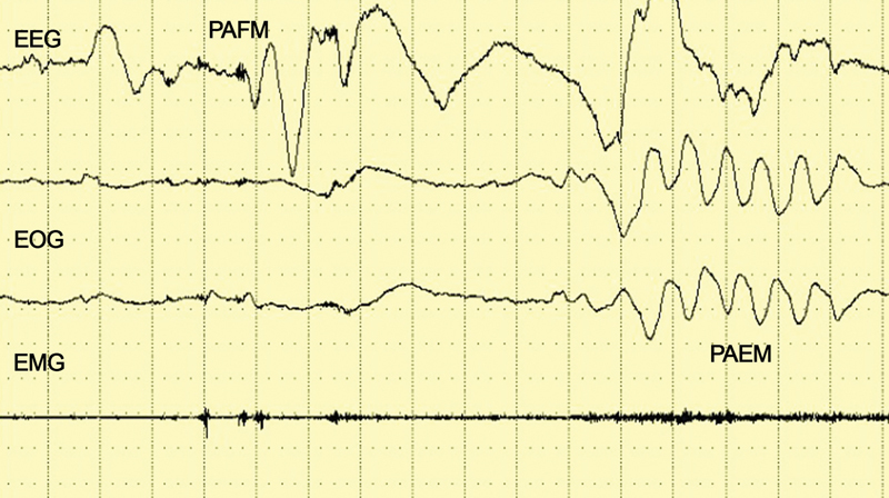 Fig. 7