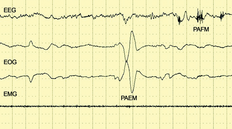Fig. 4