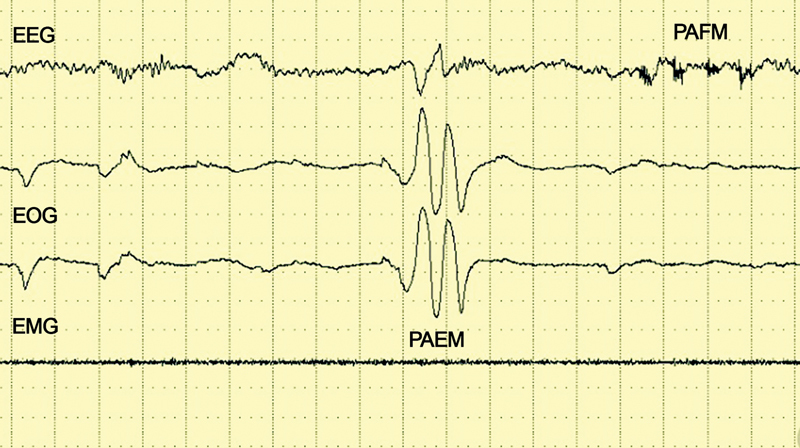 Fig. 3