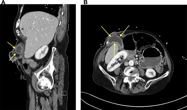 Fig. 1