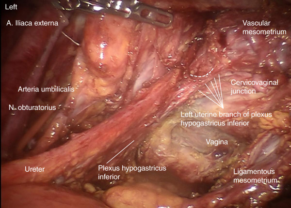 Figure 16