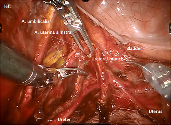 Figure 14