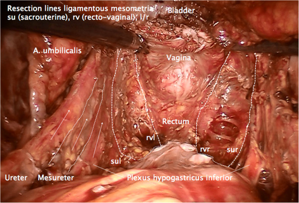 Figure 20