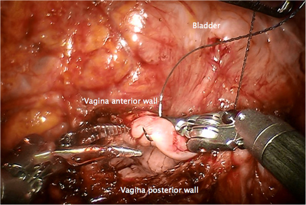 Figure 19