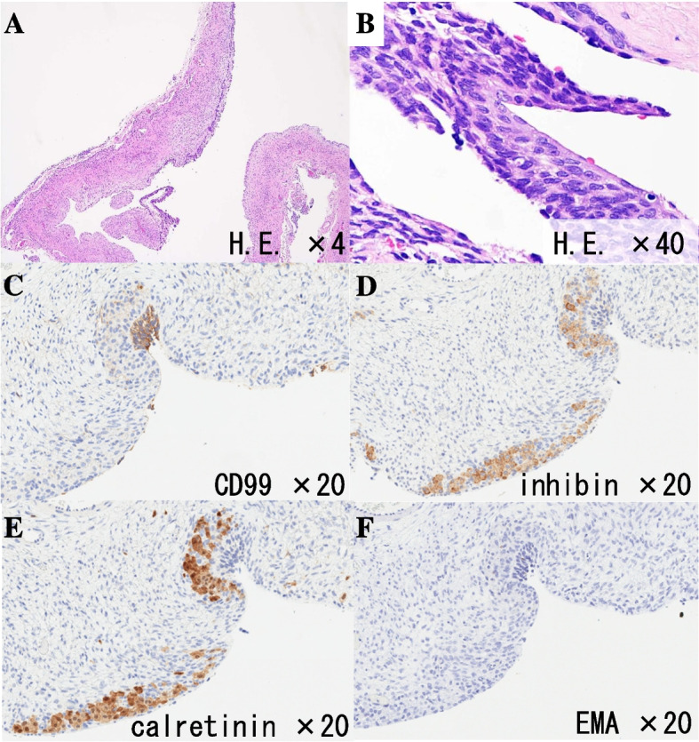 Fig. 2