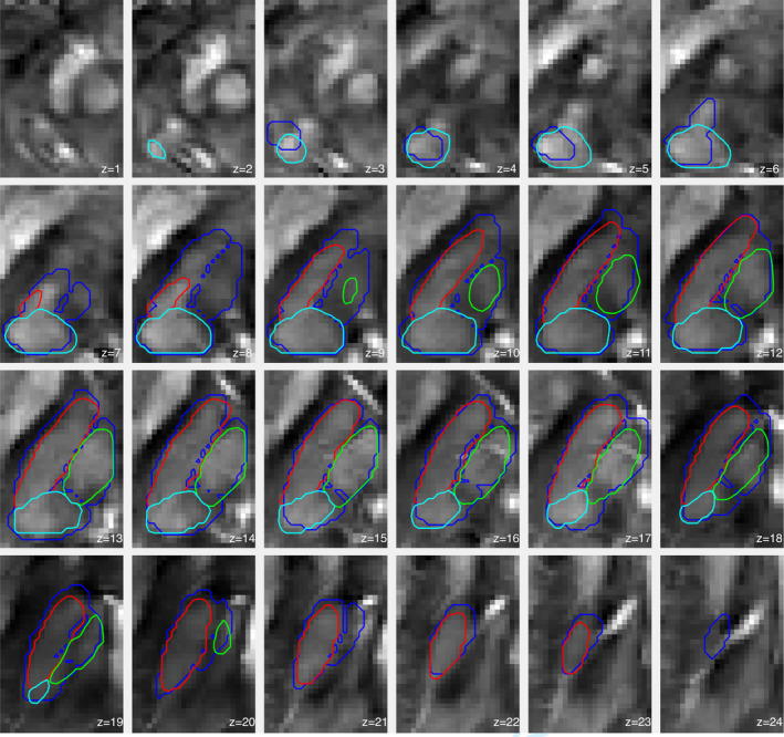 Figure 10