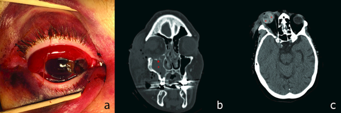 Figure 1: