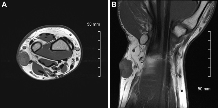 Fig. 2