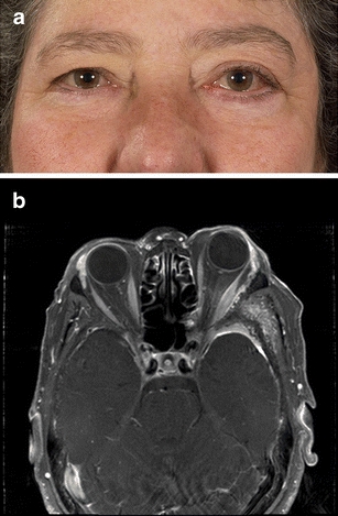 Fig. 5