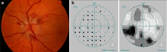 Fig. 1