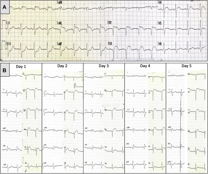 Figure 1