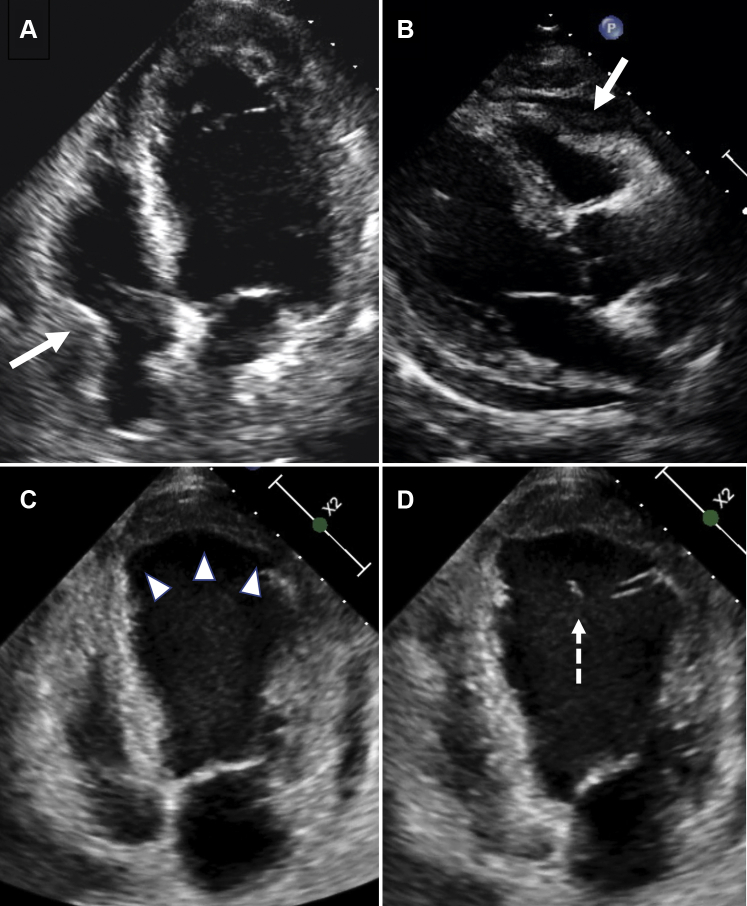 Figure 2