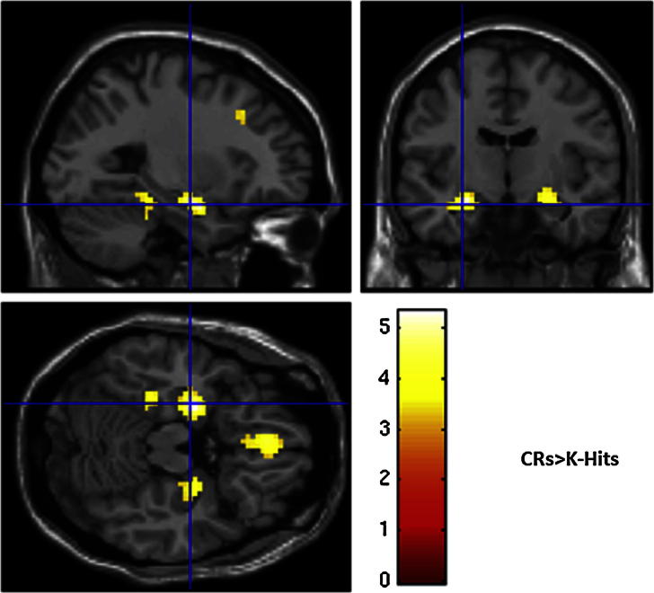 Fig. 4