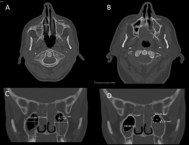 Fig 1