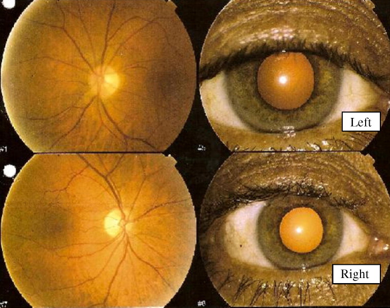 Fig. 1