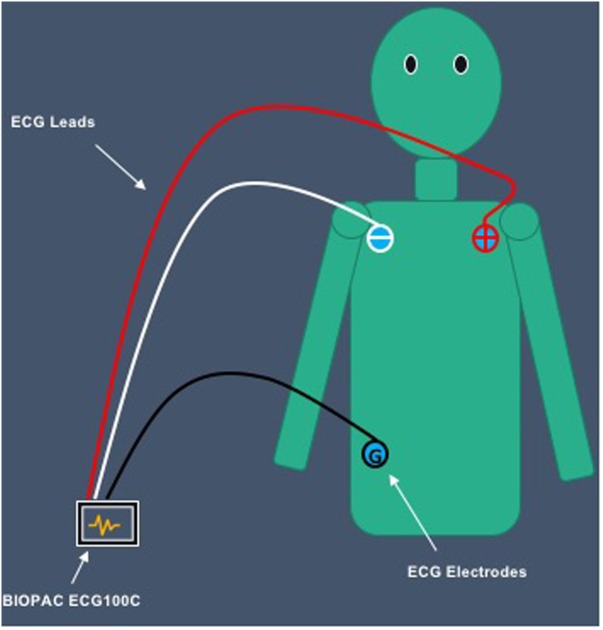 FIGURE 3