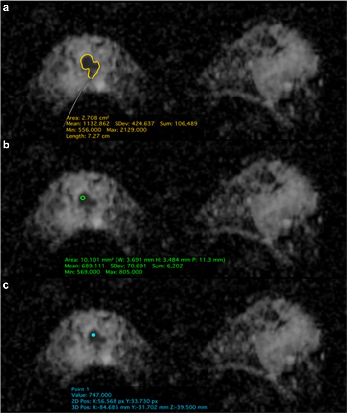 Fig. 2