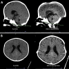 FIG. 3.