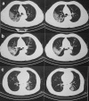 Fig. 3