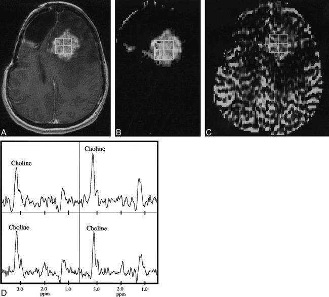 fig 6.