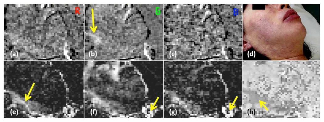 Fig. 6