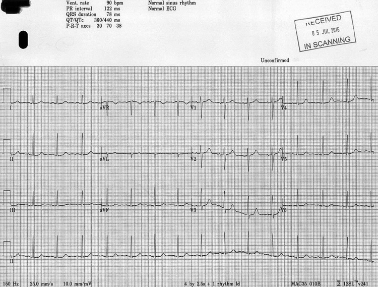 Figure 2