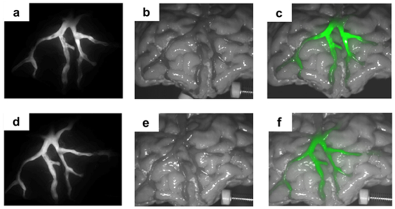 Figure 13.