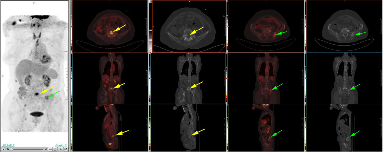Fig. 4
