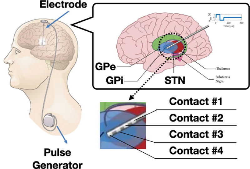 Figure 1: