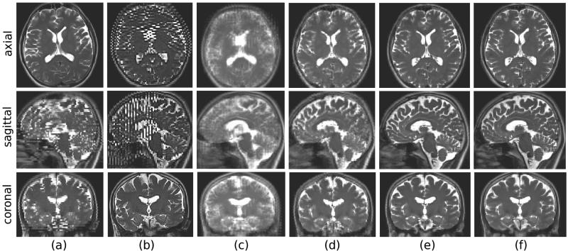 Fig.3