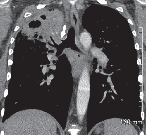 Figure 2)