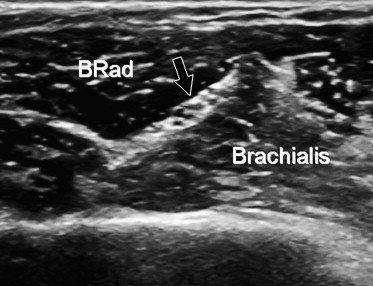 Fig. 8