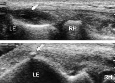 Fig. 11