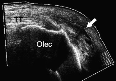 Fig. 17