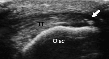 Fig. 13