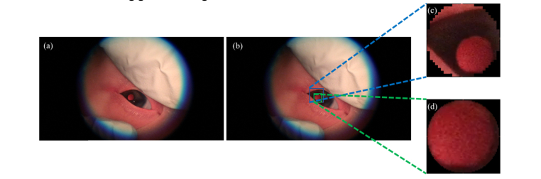 Fig. 4