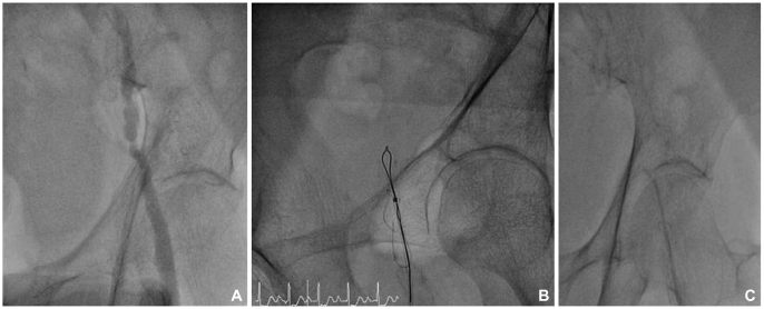 Fig. 1