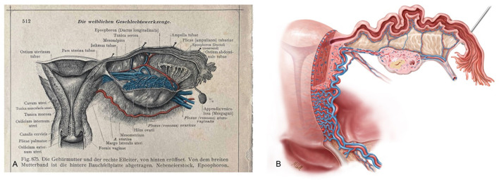 Figure 15