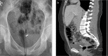 Figure 18. a, b