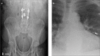Figure 20. a, b