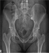 Figure 16