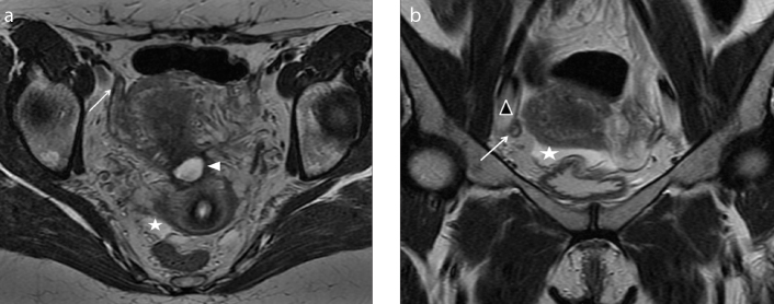 Figure 3. a, b