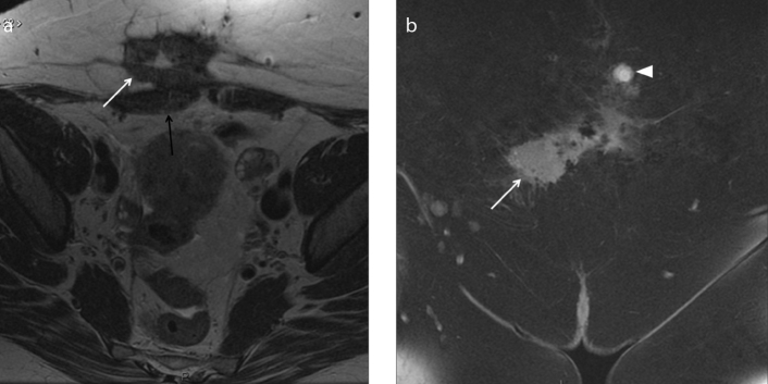 Figure 8. a, b