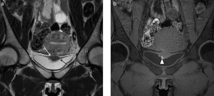 Figure 5. a, b