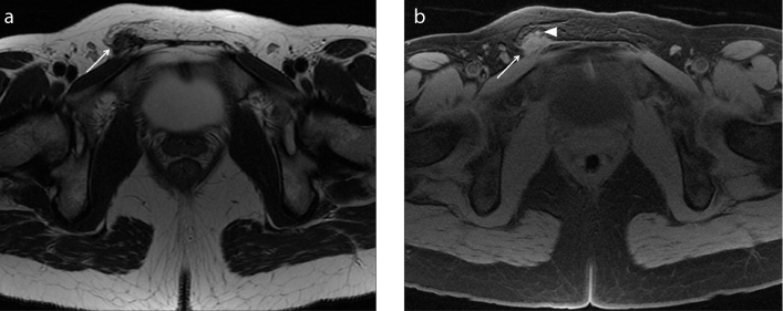 Figure 4. a, b