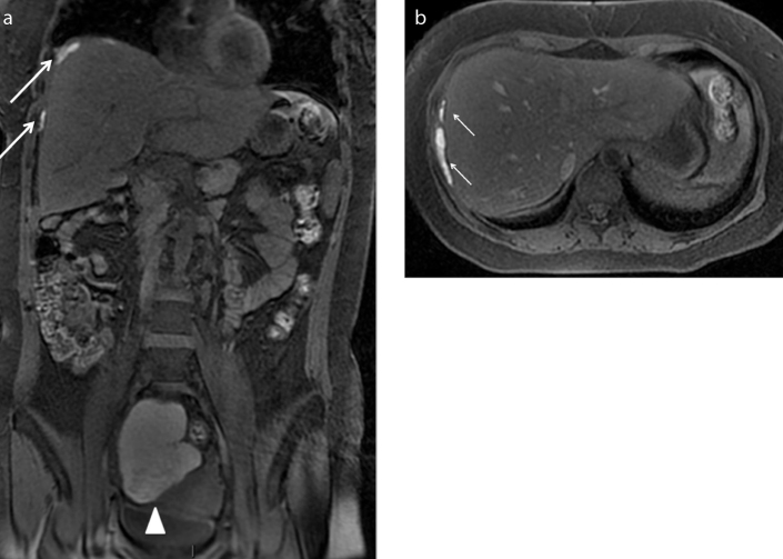 Figure 10. a, b