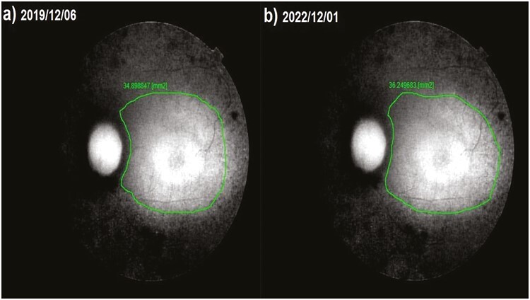 Figure 6.